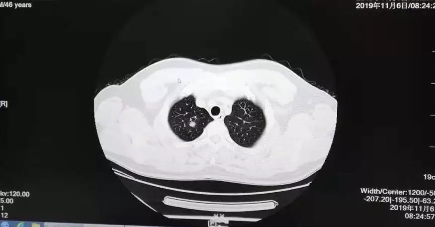 早預防，早發現，早治療 | 浩恩健康體檢十一月重大陽性數據發布